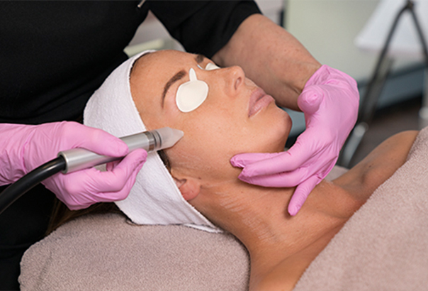 acne en microdermabrasie behandeling bij schoonheidsspecialiste beautysalon Beauty Betty Delft